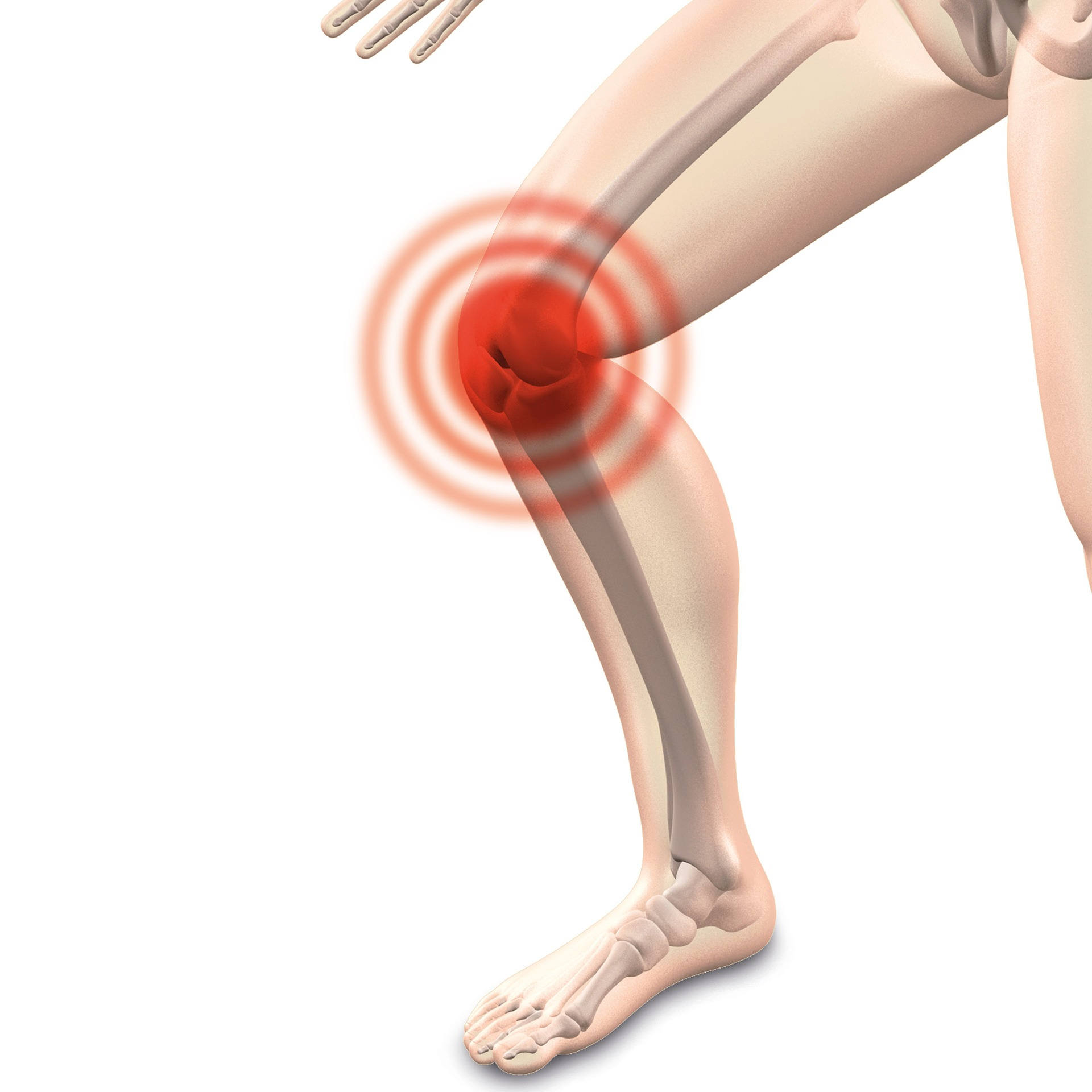 Knee Pain Treatment in Everett