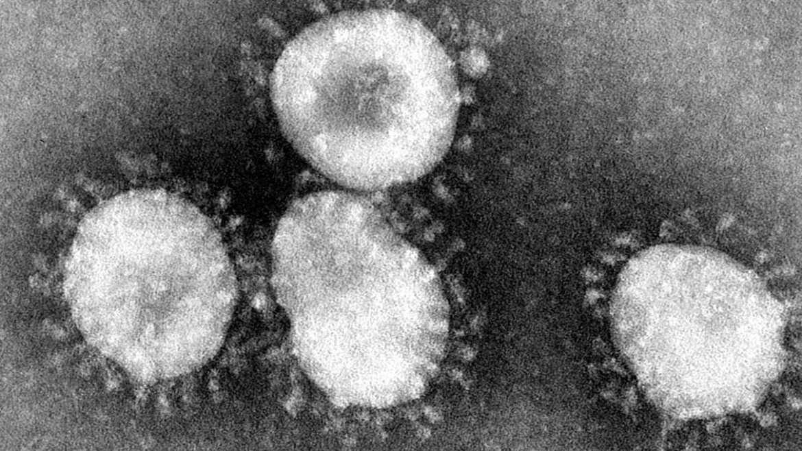 The Coronavirus: What You Need to Know