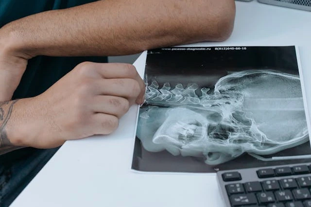 doctor reviews a head and neck xray